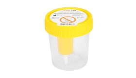 Urine potje met schroefdeksel geel