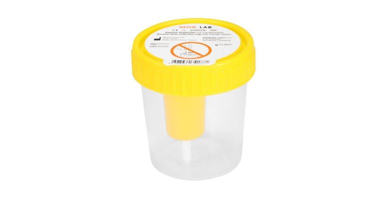 Urine potje met schroefdeksel geel